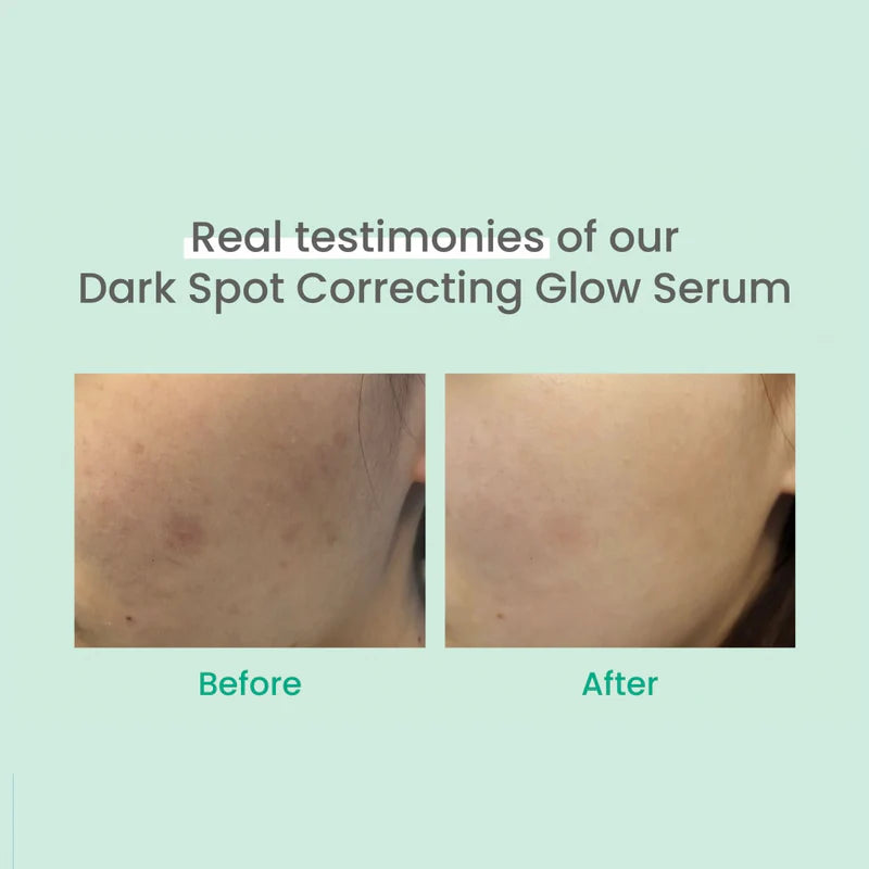 AXIS-Y Dark Spot Correcting Glow Serum 20 ml
