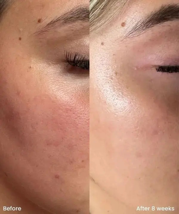 Clay And Glow 10% Niacinamide Treatment Serum