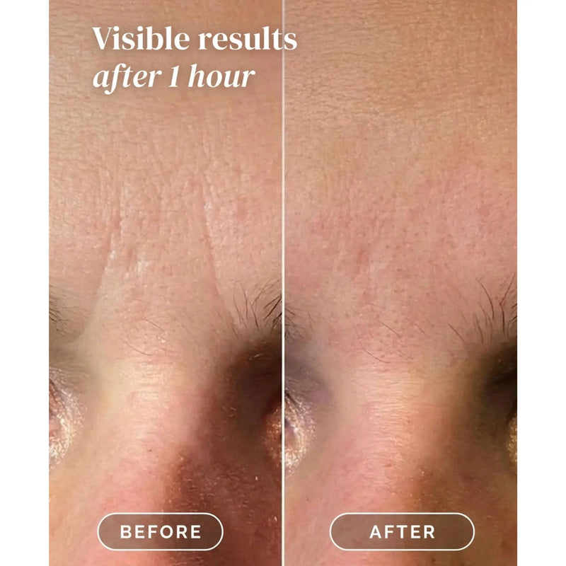 Apricot Beauty Facial Patches Niacinamide