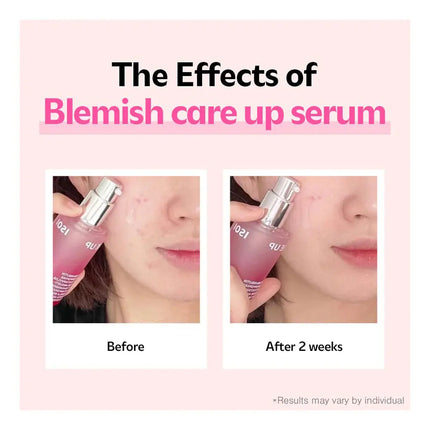 ISOI Blemish Care Up Serum