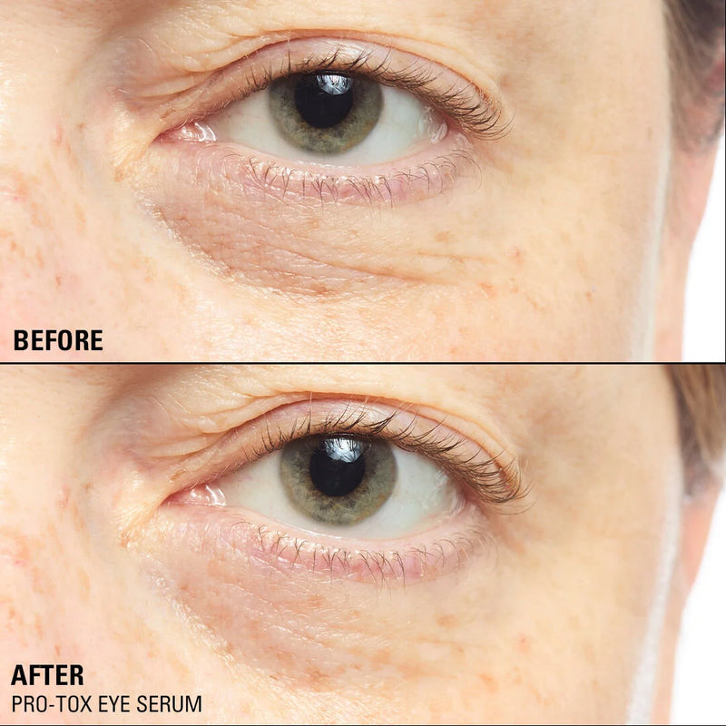 Revolution Pro-Tox Instant Fix Eye Firm