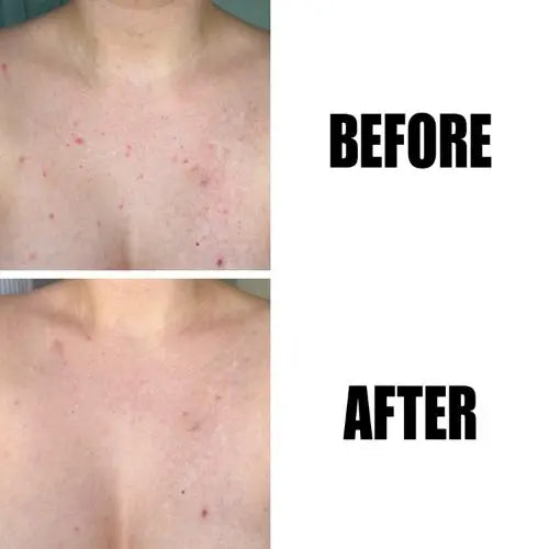 The Inkey List Glycolic Acid Exfoliating Body Stick